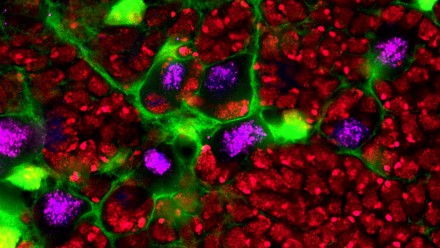neural stem cell niche