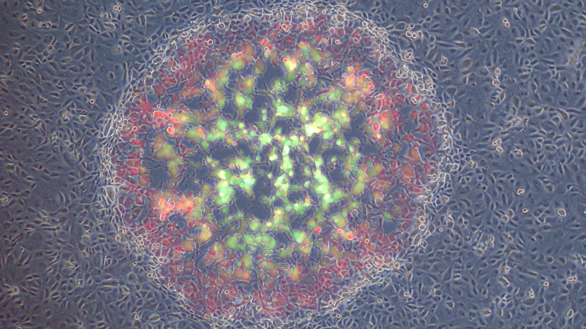 A plaque formed by the dual fluorescent reporter virus. Image: Supplied BSC-1 cells were infected with dual fluorescent reporter virus. Image: Supplied