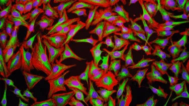 High Content Imaging &amp; Analysis